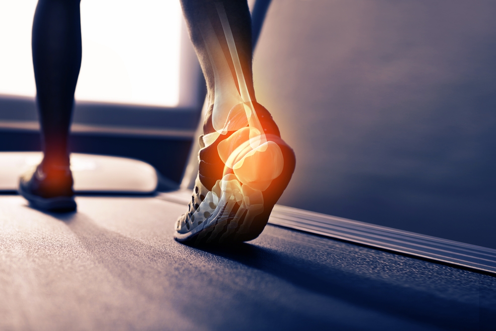Heel Pain That Won’t Go Away? What a Major Focused Shockwave Study Found for Plantar Fasciitis Heel Pain That Won’t Go Away? What a Major Focused Shockwave Study Found for Plantar Fasciitis