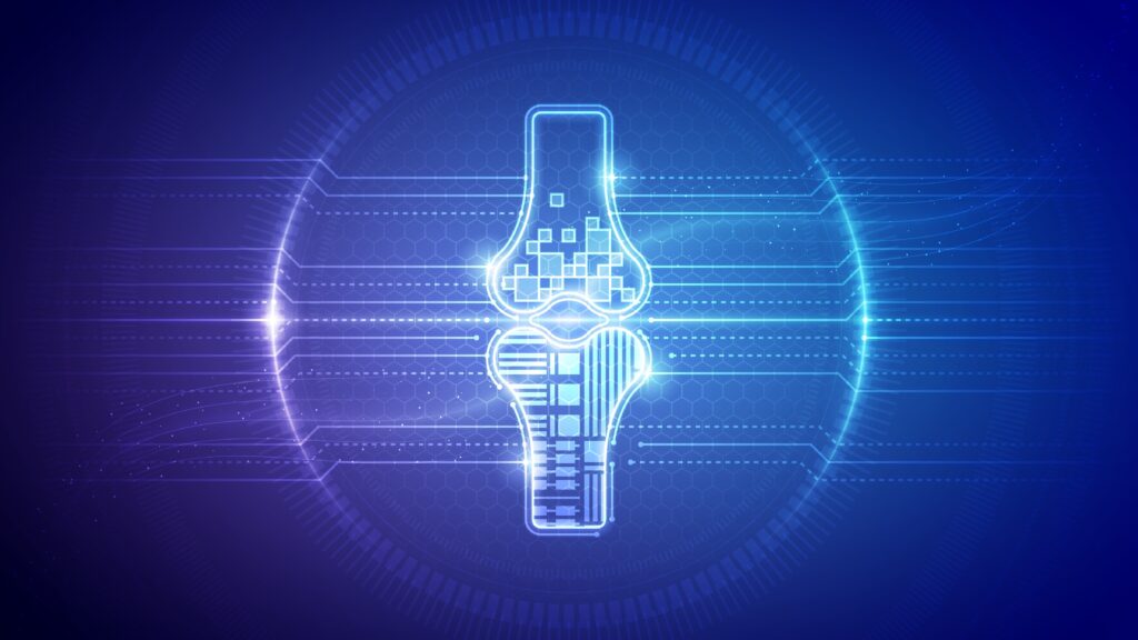 Focused Shockwave Therapy and Bone Healing: Mechanisms and Review References